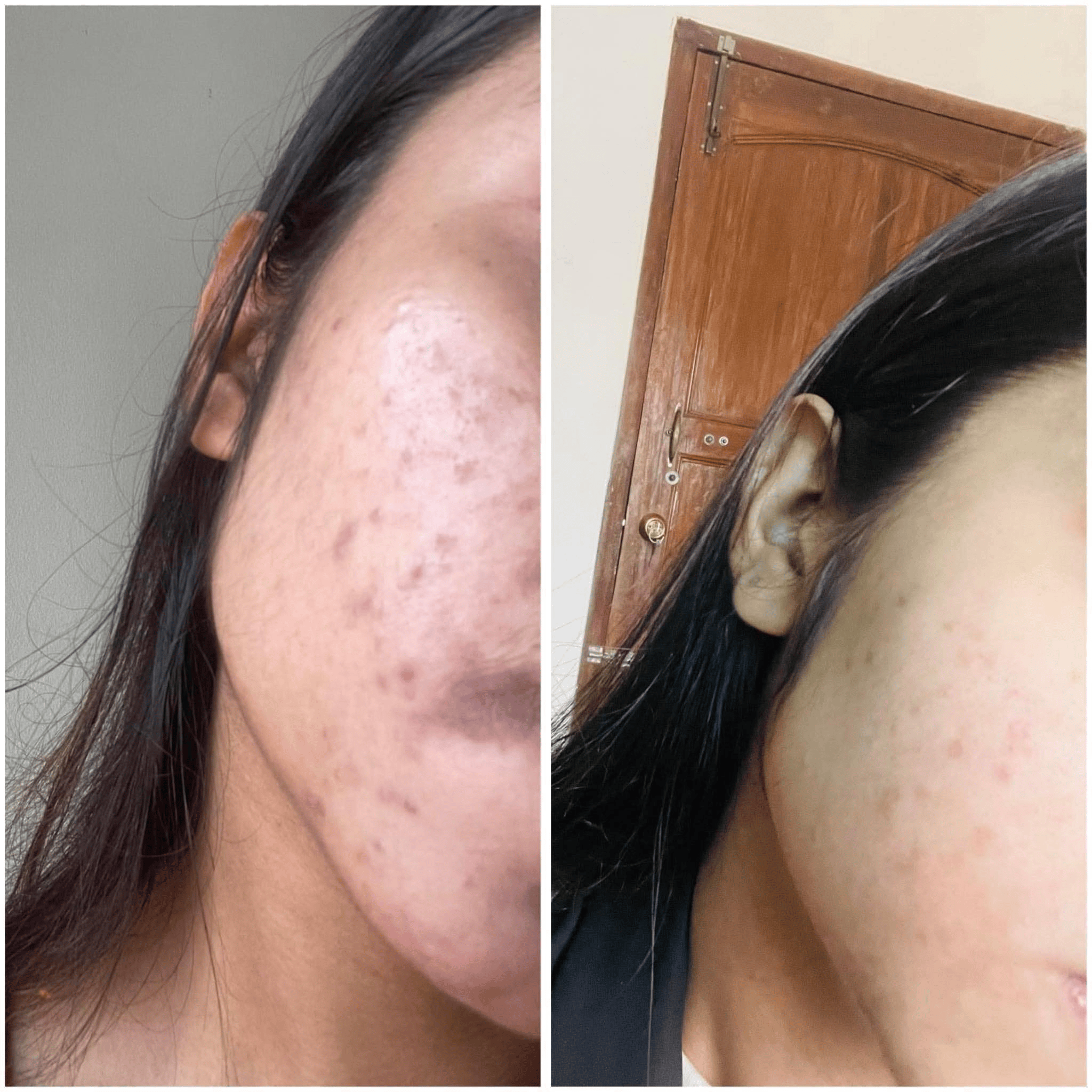 Skin Problem